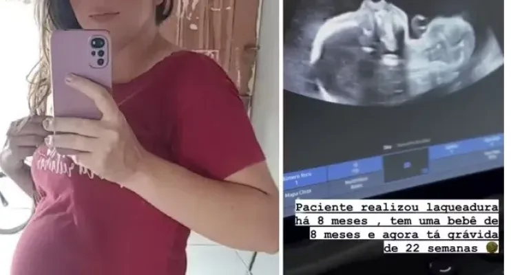 Mulher engravida após laqueadura e descobre ao sentir bebê mexendo: 'Fiquei sem chão'