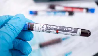 Vírus de Marburg, um dos mais letais do mundo, tem surto confirmado pela OMS
