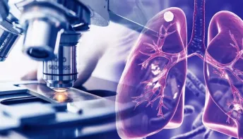 Observatório de Tuberculose desenvolve estratégias inovadoras de combate à doença