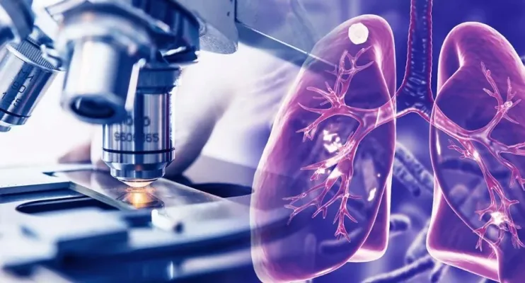 Observatório de Tuberculose desenvolve estratégias inovadoras de combate à doença