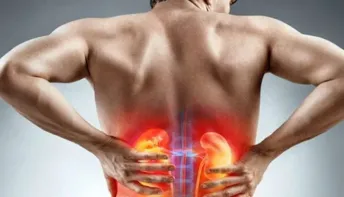 Pedra nos rins aumentam até 30% durante o verão