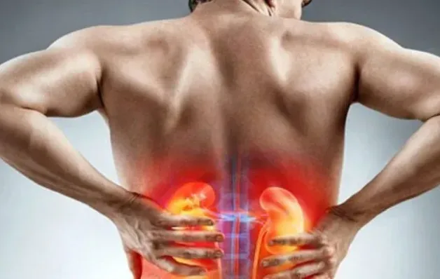 Pedra nos rins aumentam até 30% durante o verão