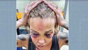 Polícia prende homem por agressão à namorada: ‘Se eu continuasse lá, iria morrer’, diz vítima
