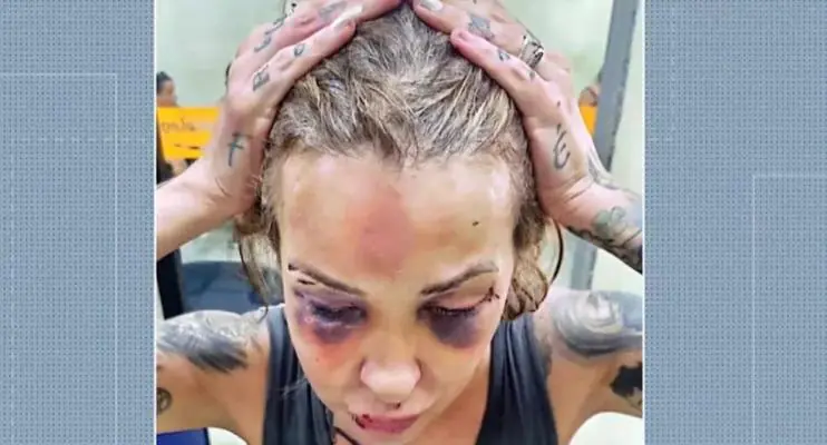 Polícia prende homem por agressão à namorada: ‘Se eu continuasse lá, iria morrer’, diz vítima