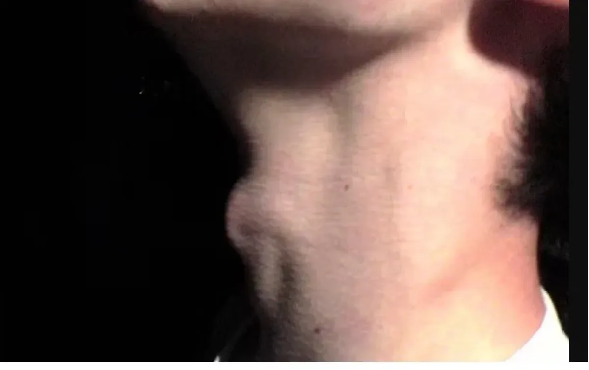 Por que homem tem gogó? Entenda protuberância masculina - Portal SBN