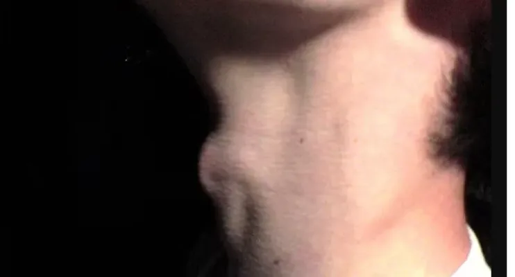 Por que homem tem gogó? Entenda protuberância masculina