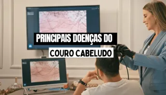 Robô vai diagnosticar doenças do couro cabeludo