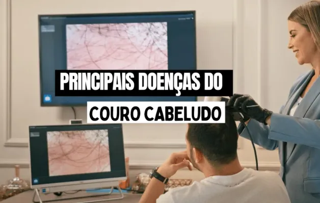 Robô vai diagnosticar doenças do couro cabeludo