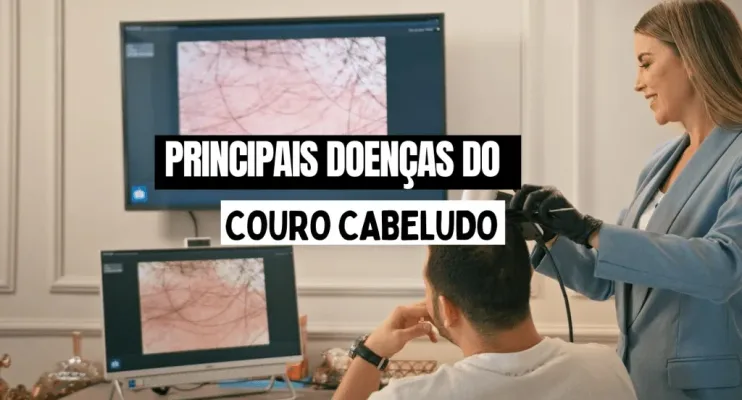 Robô vai diagnosticar doenças do couro cabeludo