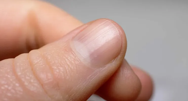 Sabe o que significam os pequenos relevos que tem nas unhas? Entenda!