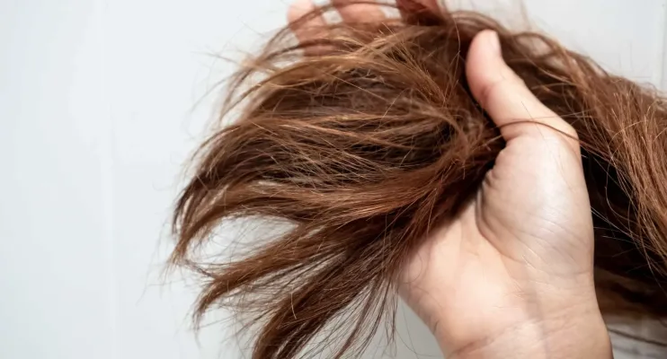 Se tem o cabelo ressecado, comece a comer estes nove superalimentos