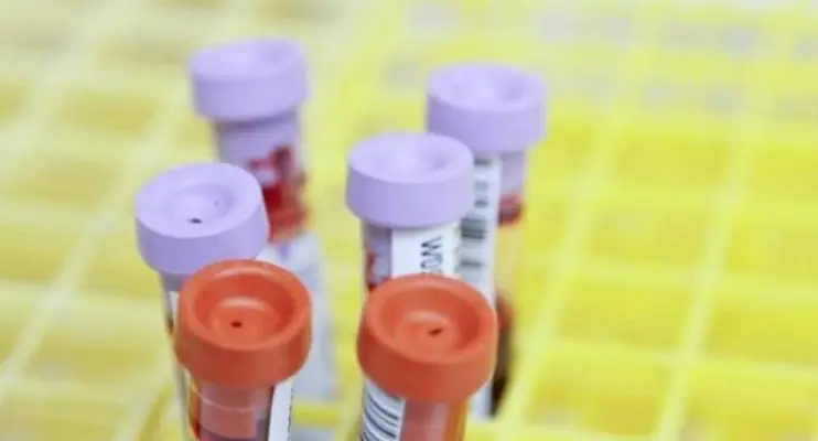 Surto de hepatite em crianças: já chega a 228 os casos confirmados pela OMS