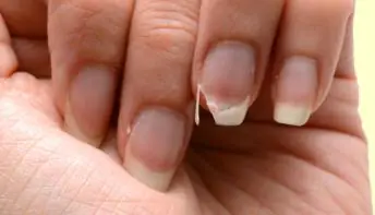 Unhas fracas e quebradiças: 3 dicas para fortalecê-las 