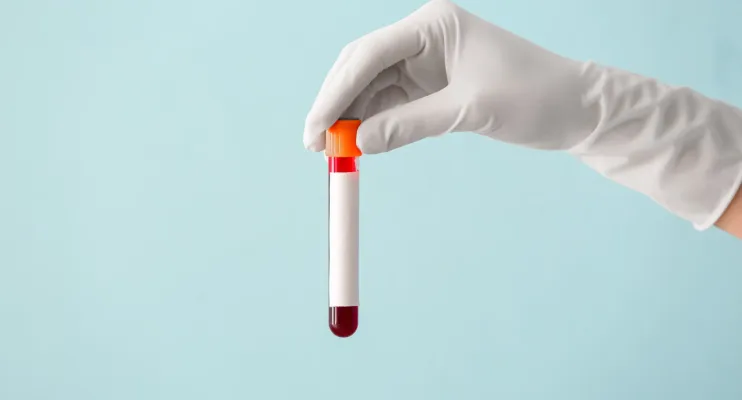 Vai fazer análises no sangue? Então, evite este tipo de comida