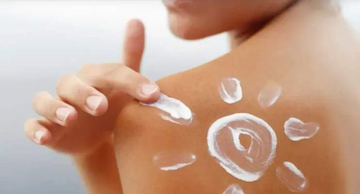 Verão: Como aliviar queimaduras solares e evitar danos à pele segundo dermatologista