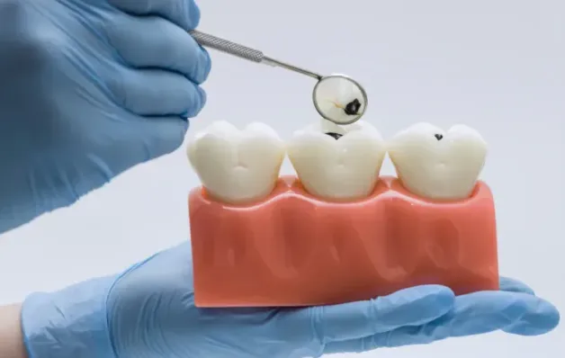 Vilões invisíveis: hábitos comuns que desgastam o esmalte dentário