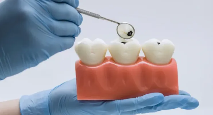 Vilões invisíveis: hábitos comuns que desgastam o esmalte dentário